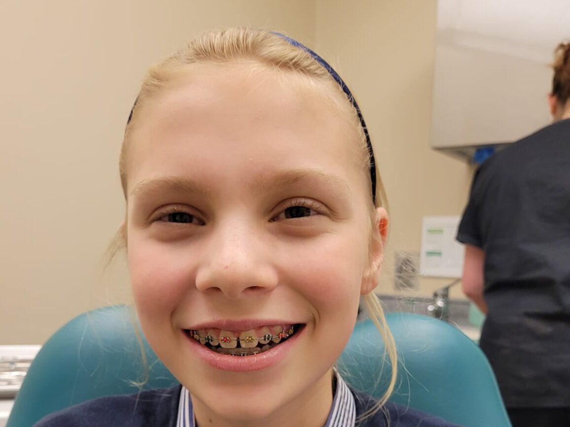 Young patient at Park Lane Orthodontics smiling with coloured fixed braces